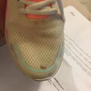 Skechers Garantili Ürün Yalanı