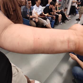 GO Sharing Mağduriyeti, Yardımcı Olmadılar