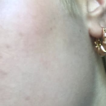 Procsin Ürünlerinin Kalitesizliği Ve İlgisizlikleri...