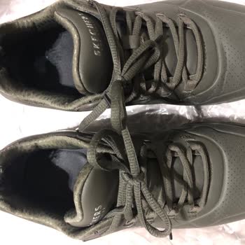 Skechers Ayakkabımın Deformesi Ve Tarafıma Sunulan Komik Gerekçe
