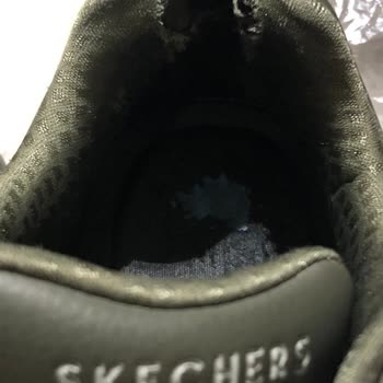 Skechers Ayakkabımın Deformesi Ve Tarafıma Sunulan Komik Gerekçe