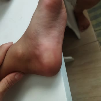 Lays Klasik Büyük Boy Aldım Fare Pisliği Çıktı