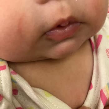 Nuk Emzik Bebeğimin Cildine Zarar Verdi