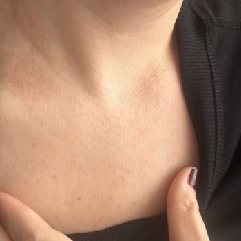 Atelier Duygunun Antialerjik Diye Sattığı Ürünleri Alerji Yapıyor