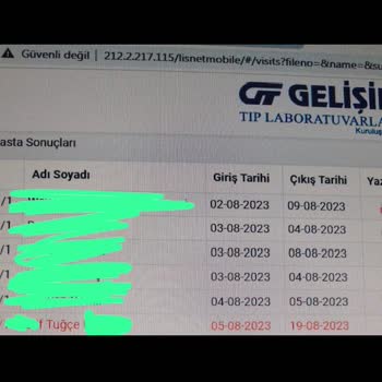 Gelişim Tıp Laboratuvarı Kan Tahlili Sonucunun Geç Çıkması