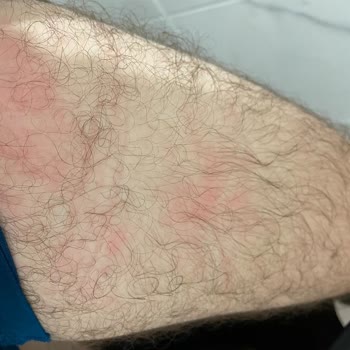 Starbucks Sıcak Kahve Karton Bardağının Patlaması