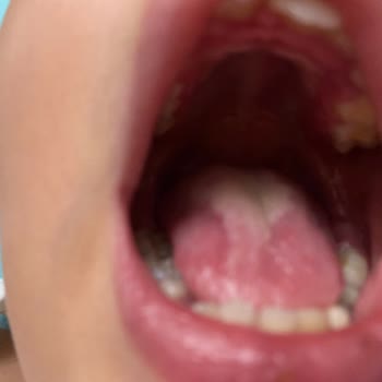 Bayraklı Belediyesi Bayraklı Yüzme Kursu'NDA Hijyen Sıfır