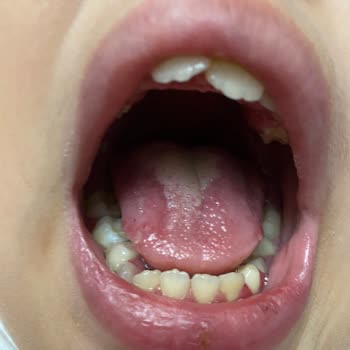 Bayraklı Belediyesi Bayraklı Yüzme Kursu'NDA Hijyen Sıfır