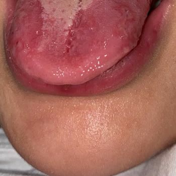 Bayraklı Belediyesi Bayraklı Yüzme Kursu'NDA Hijyen Sıfır