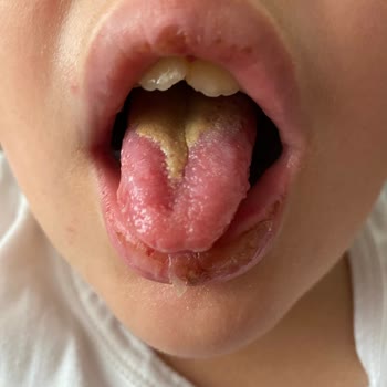 Bayraklı Belediyesi Bayraklı Yüzme Kursu'NDA Hijyen Sıfır