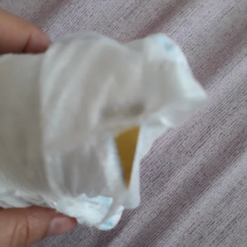 Molfix Bezde Yabancı Madde