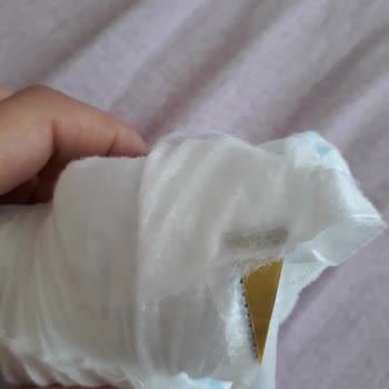 Molfix Bezde Yabancı Madde