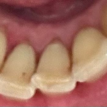 Dent İzmit Ağız ve Diş Sağlığı Polikliniği Dent Gölcük Şubesi