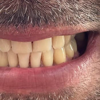 Gölcük Ağız Ve Diş Sağlığı Merkezi Dent Gölcük Hekim İş Bilmezliği Ve Mağduriyet