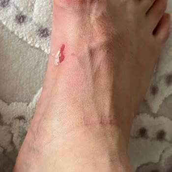 FLO Ayakkabı Forum İstanbul FLO Ayağımı Kesen Terlik İade Alınmadı.