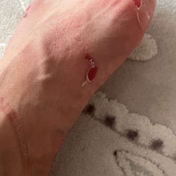 FLO Ayakkabı Forum İstanbul FLO Ayağımı Kesen Terlik İade Alınmadı.