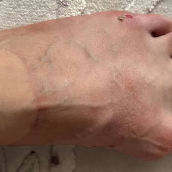 FLO Ayakkabı Forum İstanbul FLO Ayağımı Kesen Terlik İade Alınmadı.