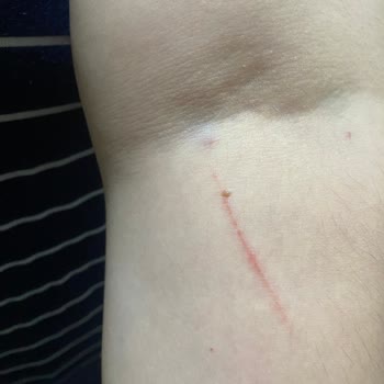 Samsun Eğitim Ve Araştırma Hastanesi Samsun Kadın Doğum Bölümü Azarlayan Çalışan!