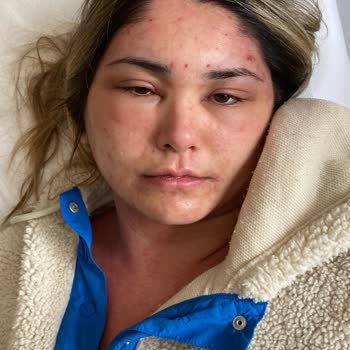 Central Hospital Hatalı İğne Sonrası Bir De Sigortamdan Para Alındı