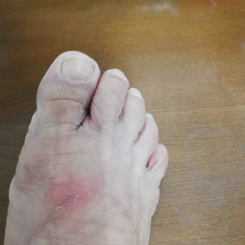 Tommy Hilfiger Terlik Yaralayıcı Ama Sorumluluk Kabul Etmiyorlar