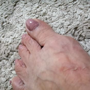 Tommy Hilfiger Terlik Yaralayıcı Ama Sorumluluk Kabul Etmiyorlar