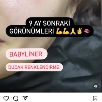 Durulife Güzellik Merkezi Aldatıcı Videoyla Reklam Yapıp Uyarınca Engelliyor!