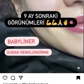 Eki aç