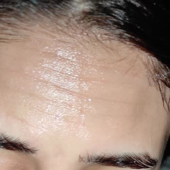 Estelia Vip Güzellik Merkezi Collagen İp Olumsuz Sonuç Olması