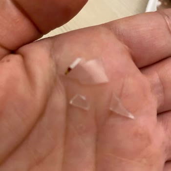 Algida Dondurmadan Plastik Parçaları Çıktı