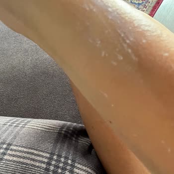 Procsin Pink Block Adı Altında Bozuk Ürün Sayıyor