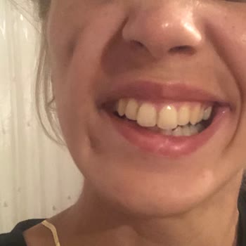 Nara Clinique Mahvolan Bir Hayat