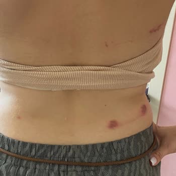 İzmir İstinyePark Vakko Wedding Müşteriyi Suçluyor!