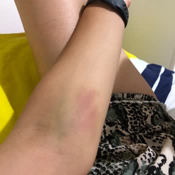 Yaşam Hastanesi (Alanya) Personelin Hakaretleri Ve Davranışları