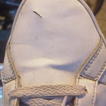 Koray Spor Adidas Ayakkabının 3 Ayda Üstü Yarıldı