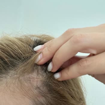 Salon Mahmut Karataş Saçlı Deriye Verilen Hasar Ve Telafi Edilmemesi