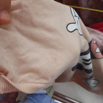 Vanish Kosla Lekeleri Çıkarmadı Verdiğim Para Çöp Tüm Kıyafetler Çöp Oldu