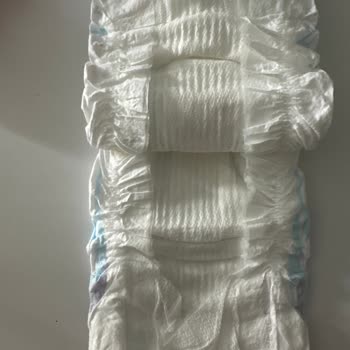 Molfix Orjinalliği Şüpheli Bebek Bezi