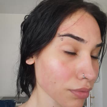 Claderm Arındırıcı Kil Maskesi Yüzümü Yaktı