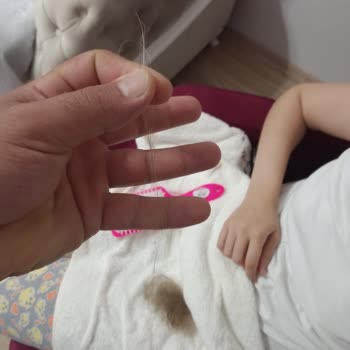 Turan Ali Bayan Kuaförü (Kırıkkale) Saç Dökülmesi