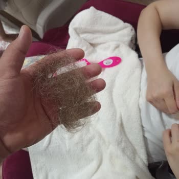 Turan Ali Bayan Kuaförü (Kırıkkale) Saç Dökülmesi