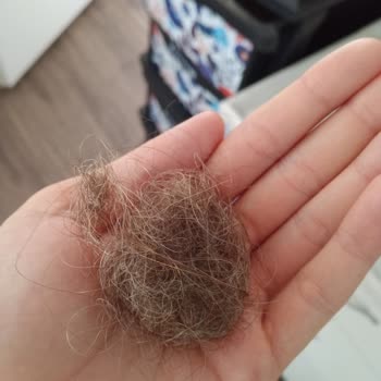 Turan Ali Bayan Kuaförü (Kırıkkale) Saç Dökülmesi