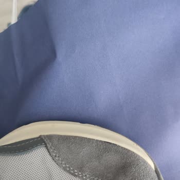 Skechers Ayakkabı Üretim Hatası Açılma