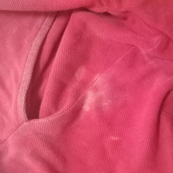 Vanish Kosla Elbiselerimde Lekeler Olmasına Sebep Oldu!