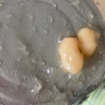 Şok Marketler Vatan Haşlanmış Fasulye Bozuk Çıktı