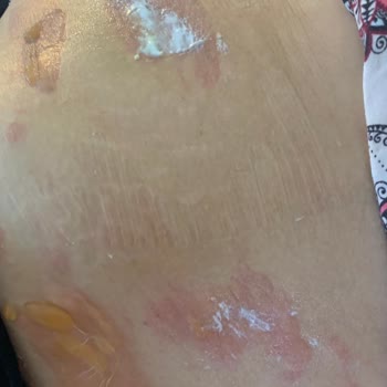 Penguen Home Penguen Marka Çelik Termos Annemin Yanmasına Sebep Oldu