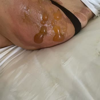 Penguen Home Penguen Marka Çelik Termos Annemin Yanmasına Sebep Oldu