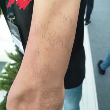 Lovemed Güzellik Merkezi İşlerine Sahip Çıkmıyor