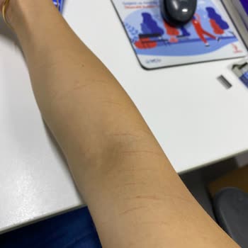 Suna Görer Güzellik Merkezi (Gebze) Lazerle Tüm Vücudumu Yanık Yaptılar