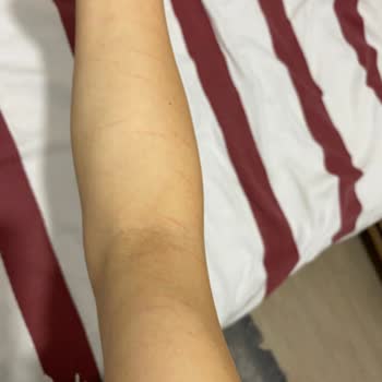 Suna Görer Güzellik Merkezi (Gebze) Lazerle Tüm Vücudumu Yanık Yaptılar