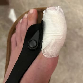 Concorde Luxury Resort Casino Sağlık Problemi Sonucu Yaşanan Mağduriyet